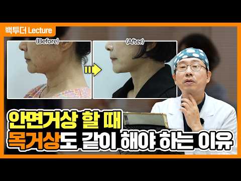 안면거상만으로 안 되는 목주름·무턱? 안면거상+목거상 동시에 해야 하는 이유