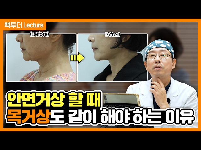 안면거상만으로 안 되는 목주름·무턱? 안면거상+목거상 동시에 해야 하는 이유