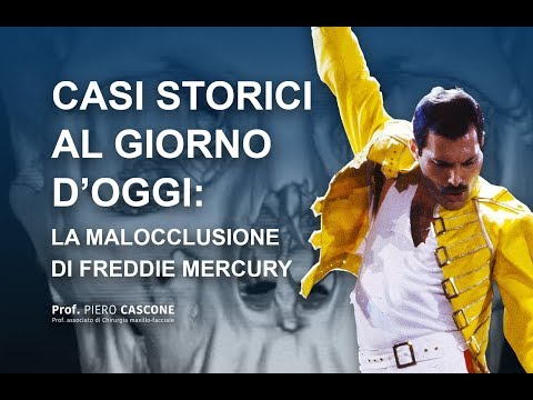 Casi storici al giorno d’oggi: la verità sui denti di Freddie Mercury