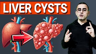 Liver Cysts: Harmless or Deadly? What You Need to Know