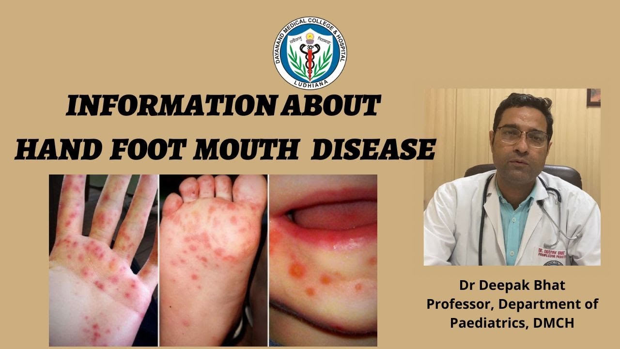 Information about Hand Foot & Mouth Disease II Awareness II Prevention