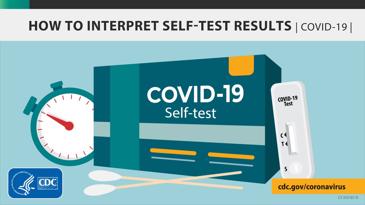 What the CDC Says About Rodents & COVID-19