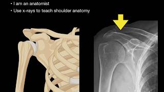 Anatomy of Shoulder X-rays