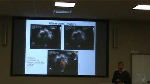 Prof. Charles L. Epstein -- Part 1 (March 11, 2016 UMKC -- AMG)