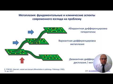 Метаплазия - путь к раку? 170 лет изучения