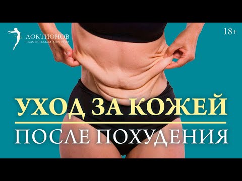 Обвисшая кожа после похудения: как предотвратить? // 18+