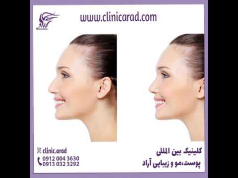 بهترین دکتر عمل زیبایی بینی در مشهد