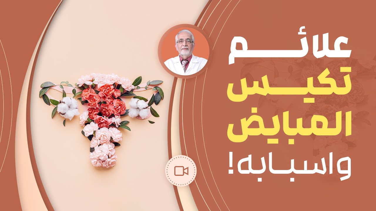 تكيس المبايض : علائم تكيس المبايض و اسبابه !