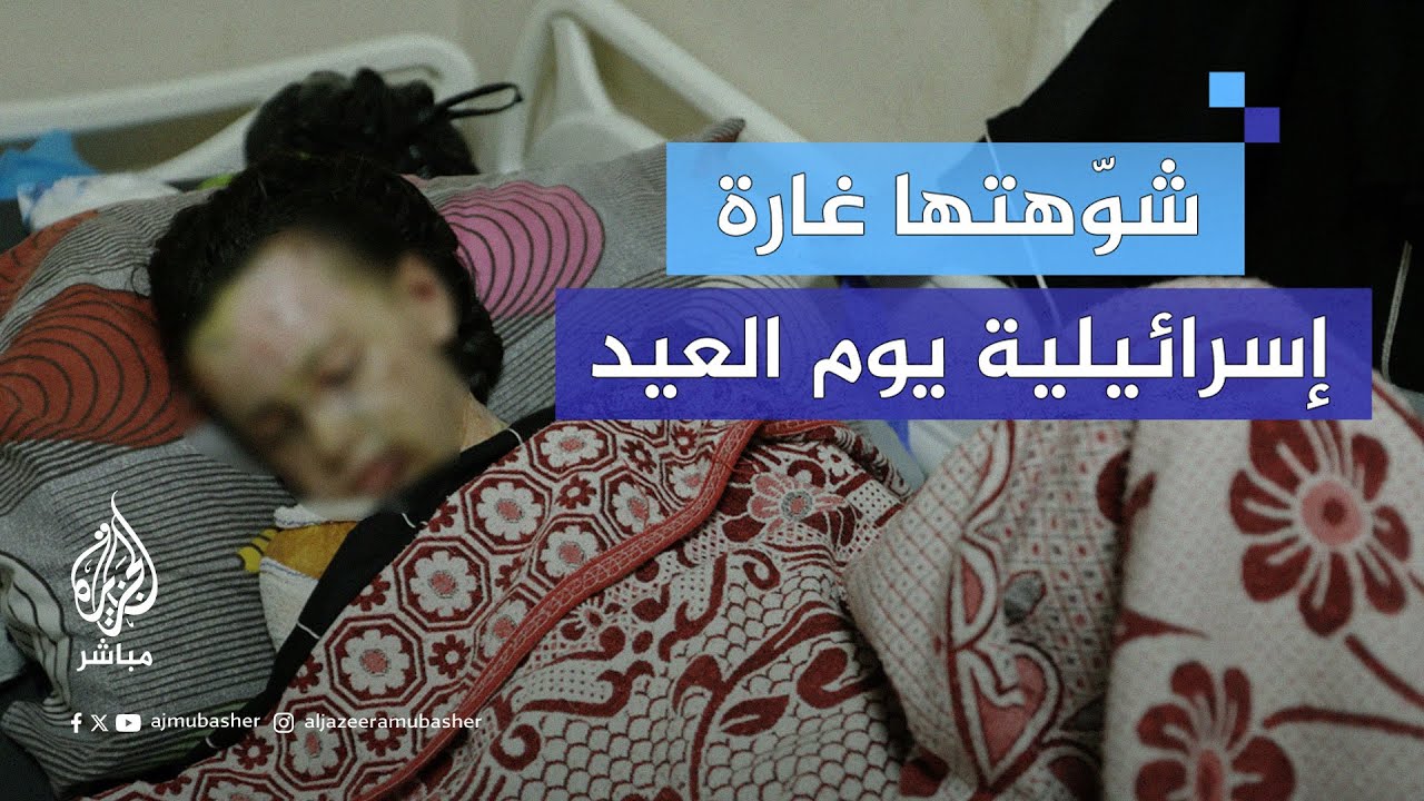 حنان عقل.. طفلة فلسطينية شوّهتها غارة للاحتلال يوم العيد تناشد للعلاج بالخارج