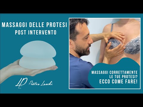 Video: Coppe per il seno in silicone: pro o contro?