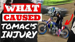 Tomac's Massive Injury Preventable | Breakdown! Mistakes