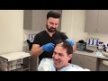 FUE Hair Transplant Surgery in Los Angeles and FUE Hair Restoration in LA, Beverly Hills, Hollywood