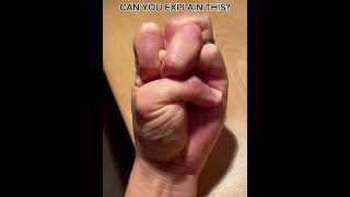 Impossible Hand Challenge Pt. 1