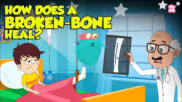 How Bone Fractures Heal? | How Does a Broken Bone Heal? | Process of Bone Healing | Dr. Binocs Show