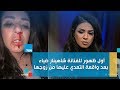 أول ظهور للفنانة شاهيناز ضياء بعد واقعة التعدي عليها من زوجها