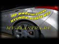 Замена 🔧 троса ручника Hyundai Avante MD