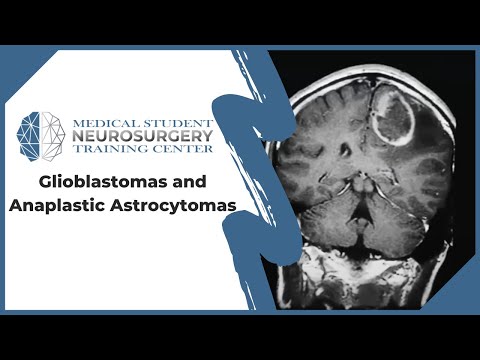 Glioblastomas மற்றும் Anaplastic Astrocytomas