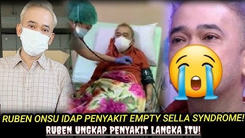 MENGERIKAN❗RUBEN ONSU IDAP PENYAKIT EMPTY SELLA SYNDROME || PENYAKIT LANGKA😱