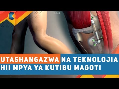 Video: Jinsi Ya Kuchagua Pedi Za Magoti