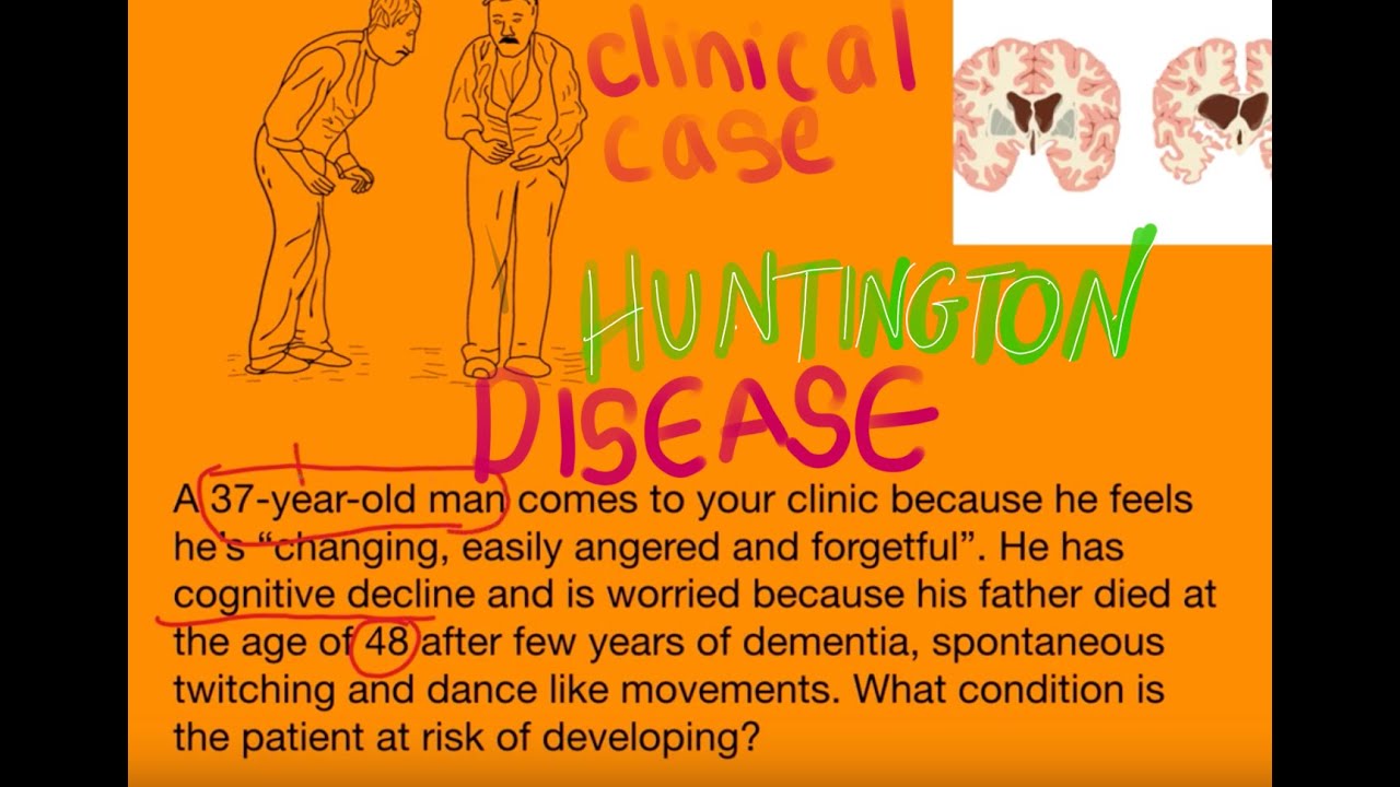 Huntington Disease patient symptoms in 10 minutes neurology medicine