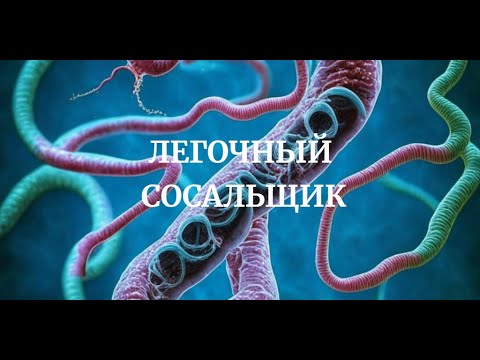 Легочный Сосальщик (Paragonimus westermani) Медицинская Паразитология Симптомы Цикл Диагностика