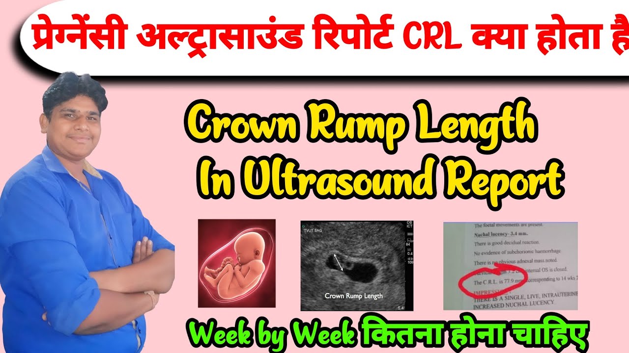 CRL Means In Pregnancy CRL In Ultrasound Report Crown Rump Length CRL Means In Pregnancy CRL In Ultrasound Report Crown Rump Length