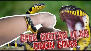 Efek gigitan ular cincin emas, Bisa mati ?