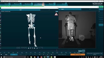 Running Gait Analysis: Passive Shock Absorption