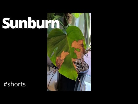 Video: Gardener Sun Protection: How To Stop Gardening Solbränna