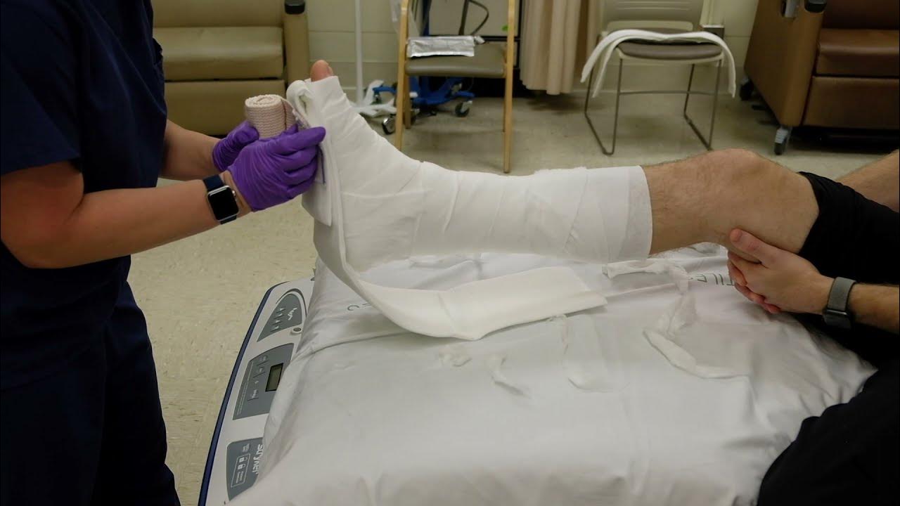 Bulky Jones Splint YouTube