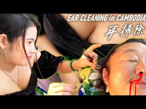 耳かき/耳掃除 カンボジアのベトナム理髪店 Cambodia Ear cleaning ASMR