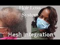 Mesh Integration Hair Loss System: No braided weave | No wig | Minimal tension