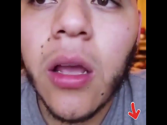 perfect smile veneers для чего розовая пластина