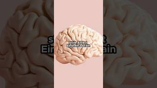 Celebrity Someone stole Einstein brain Wealth