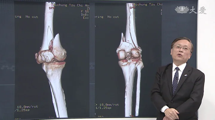 【大愛醫生館】20190305 - 骨折的自我療癒 - 天天要聞