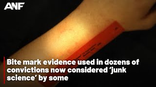 Famous Bite mark evidence used in dozens of convictions now considered ‘junk science’ by some Net Worth