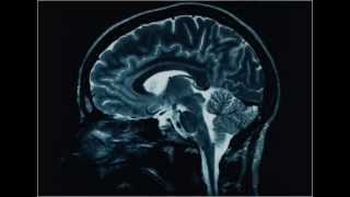 Braininjurylawyers - Brain Injury Resource Center