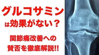 【グルコサミン】は効果がない?!関節痛改善に対する賛否を徹底解説!!