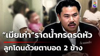 &quot;เมียเก่า&quot; ย่องราดน้ำกรดรดหัวแม่ ตอนอาบน้ำน้อง ทำเด็กตาบอด 2 ข้าง | 29 เม.ย. 67 | คุยข่าวเช้าช่อง8