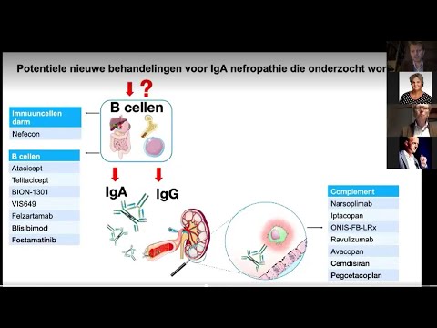 Video: 3 manieren om te weten of een Nefertiti-lift geschikt voor u is