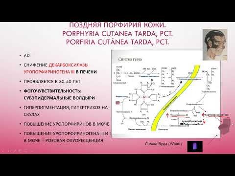 Видео: Porphyria Cutanea Tarda: снимки, лечение и др