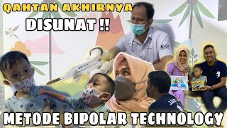 Memutuskan Begitu Lama Sunat Pakai Metode Bipolar Technology, Pulang Jalan Sendiri