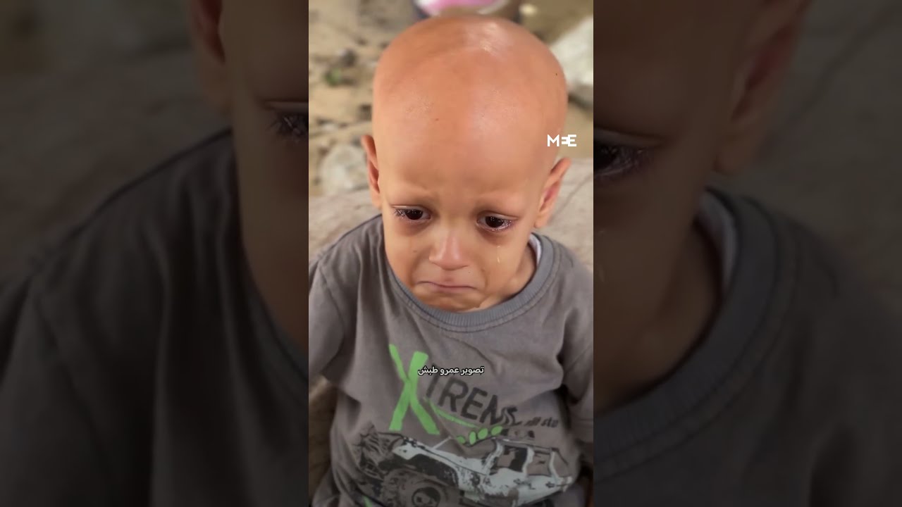 Gaza Child Cries From Hunger As Israel Continues To Block Humanitarian Aid