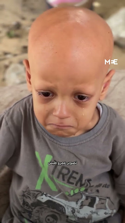 Gaza child cries from hunger as Israel continues to block humanitarian aid