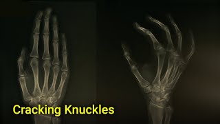 This is what happens when you crack your knuckles