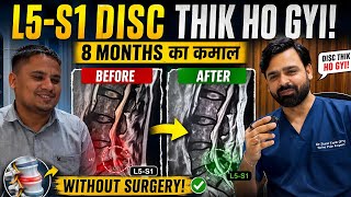 बिना Surgery L5-S1 Disc हुआ ठीक 😲 | MRI Before After Recovery Result