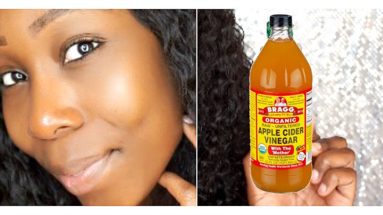 How To Get Clear Glowing Skin In 7 Days: DIY ACV Toner! - YouTube