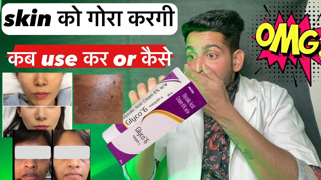 Skin को गोरा कैसे करे कब और कैसे लगाये Glycolic acid cream 6 w/w