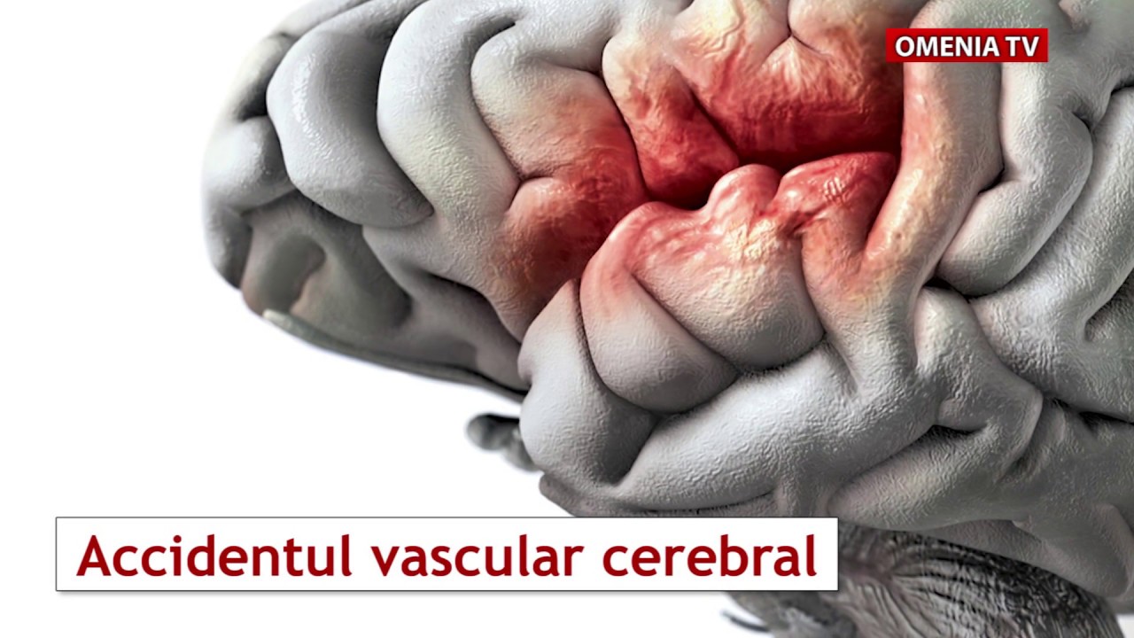 tratamentul parazitului cerebral