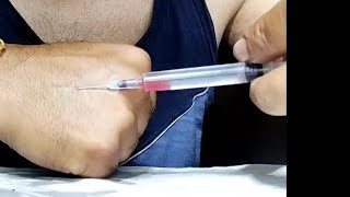 اتعلم بنفسك طريقة  الحقن في الوريد Give yourself the injection